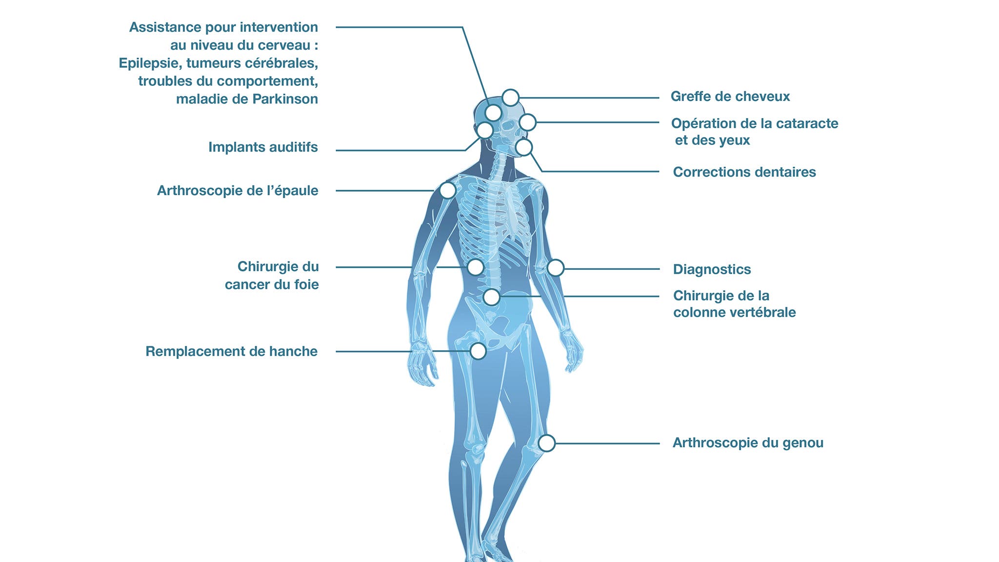 Robotics medical nos references - fr